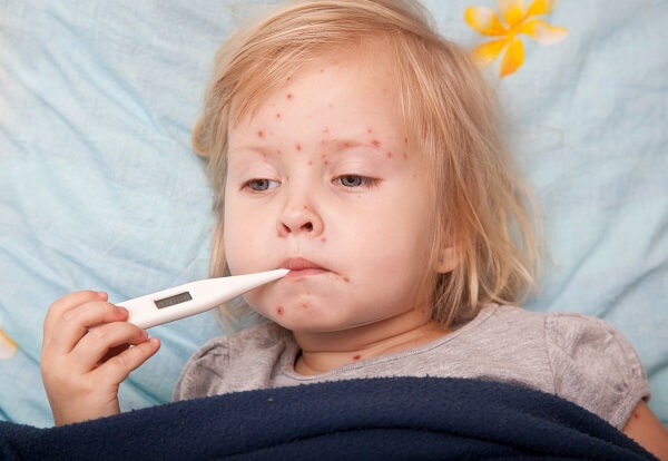 Mẹ lưu ý một số dịch bệnh xu hướng tăng trong mùa xuân để bảo vệ trẻ-2